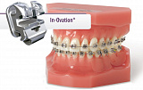 KIT Брекет-система IN-OVATION C BASE 022/U5-5/L3-3 (Dentsply)