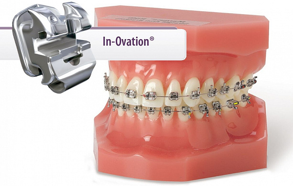 Купить KIT Брекет-система /KBH189-012-17/IN-OVATION C+R CCO 022/U5-5 L3-3/L4-5 (Dentsply)